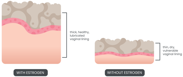 medical stylized diagram showing vaginal lining with and without estrogen
